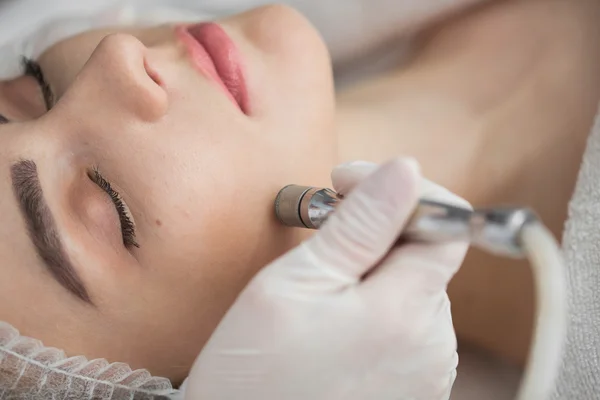 Facial Microdermoabrasión